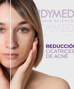 Cicatrices, acné, poros y rosácea 1 sesión