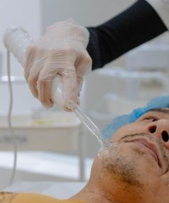 Tratamiento Facial