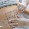 Lipoescultura sin cirugía 2 sesiones SCIZER + radiofrecuencia y drenaje linfático