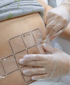 Lipoescultura sin cirugía 2 sesiones SCIZER + radiofrecuencia y drenaje linfático