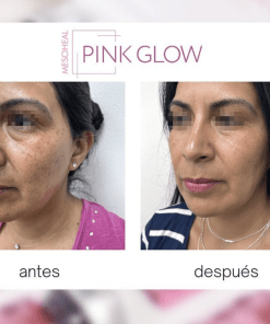 vitaminas pink glow