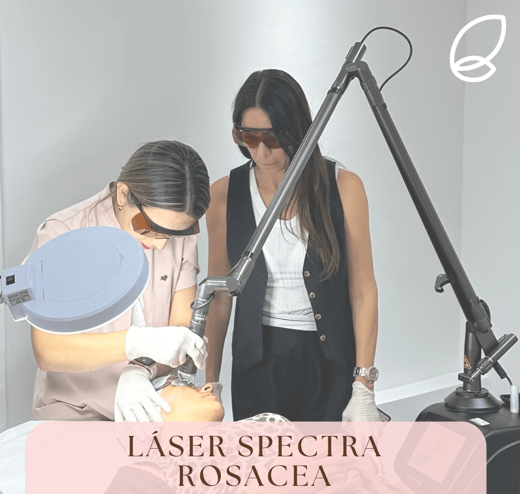 Tratamiento Láser Spectra para Rosácea